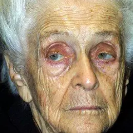 Rita Levi-Montalcini net worth