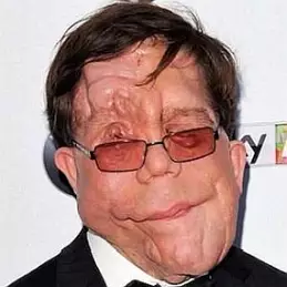 Adam Pearson net worth