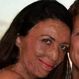 Turia Pitt net worth