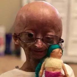 Adalia Rose net worth