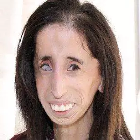 Lizzie Velasquez net worth